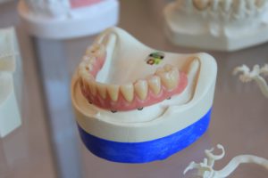 【Japanese Vocabulary】Teeth:歯(は)